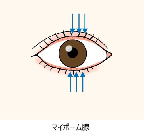 ものもらい - HOYA株式会社